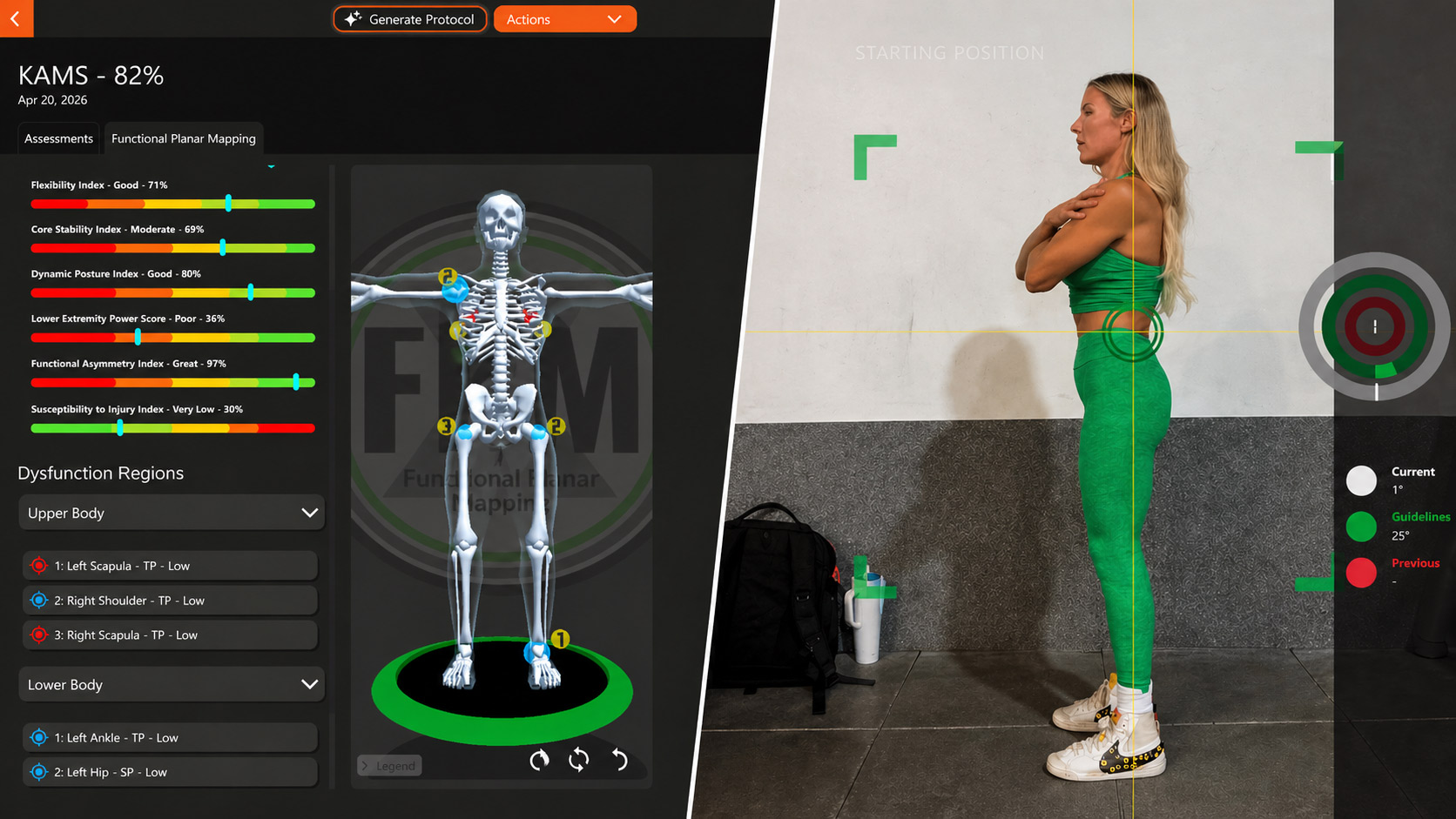 Pronesis movement assessment software showing KAMS score of 82% and functional planar mapping dashboard with client in starting position